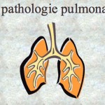 Pathologie pulmonaire